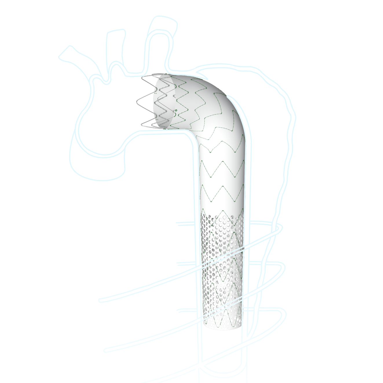 talos™ thoracic stent graft system